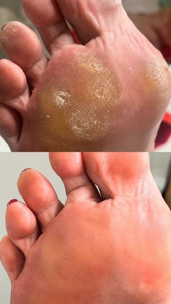 pedicure